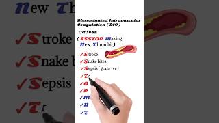 Causes of Disseminated Intravascular Coagulation  DIC [upl. by Kiele]