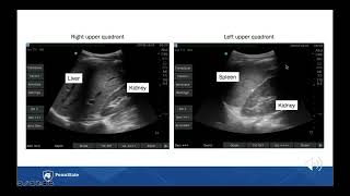 eFAST for EMS Appendix M Left Upper Quadrant View [upl. by Scurlock]