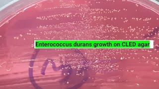 Enterococcus durans growth on CLED agar of urine culture [upl. by Yahsal]