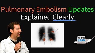 Pulmonary Embolism  Thromboembolism Updates Explained Clearly [upl. by Breanne963]