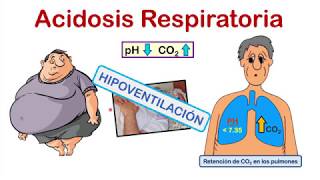 INTERPRETACIÓN DE LA GASOMETRÍA EN 4 PASOS 💉💉 con EJERCICIOS de PRÁCTICA al final del video [upl. by Eneles]