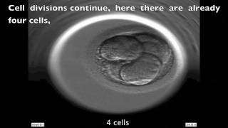 INSTITUT MARQUÈS  Development of a human embryo seen with Embryoscope [upl. by Mllly]