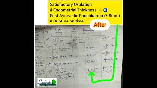 THIN ENDOMETRIUM TREATED WELL BY AYURVEDA AND PANCHKARMA [upl. by Ydollem141]