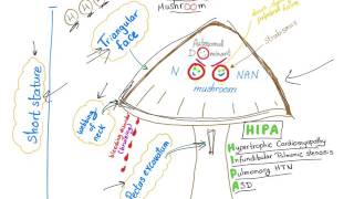 Noonan Syndrome  The Mushroom mnemonic [upl. by Ecirtal]