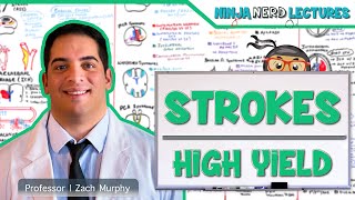 Ischemic and Hemorrhagic Strokes  High Yield [upl. by Retsek]