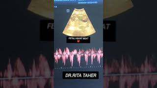 Fetal heart beat pregnanacy usg ultrasound [upl. by Artemas]