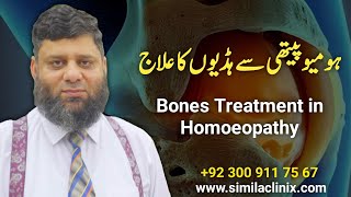 Bones Treatment in Homoeopathy  اردو  हिन्दी  Dr Ahmed Ejaz Official [upl. by Brody178]