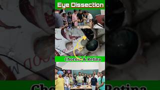 I Dissected An Eye And Heres What I Found [upl. by Adekram]