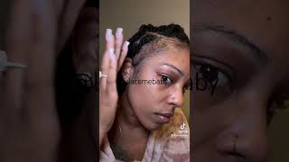 How I use Minoxidil 5 for my edges alopecia hairlosstreatment minoxidil hairlossmedication [upl. by Eibob]