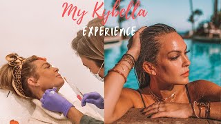 My Kybella experience Before and After 2 kybella treatments [upl. by Celene]