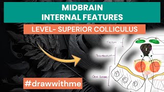 Midbrain Cross Sectional Anatomy  Internal features  level of Superior Colliculus [upl. by Ayra]