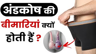 अंडकोष की बीमारियां क्यों होती हैं  Causes of Hydrocele  Causes of Varicocele in Hindi [upl. by Wandis]