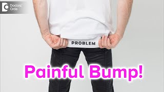 Painful bump on buttocks Causes Symptoms amp Treatment  Dr Rajdeep Mysore  Doctors Circle [upl. by Junno975]