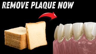 NATURAL WAYS TO REMOVE PLAQUE ASAP [upl. by Burck]