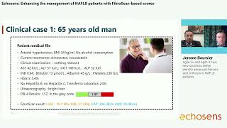 FibroScan®based Scores in NAFLD patient management [upl. by Eahsat]