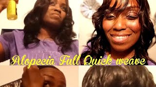 Alopecia Full Quick weave Full Quick weave on Hairloss no leave out only music playing [upl. by Selwin]