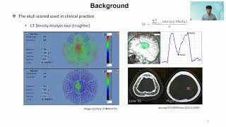 Changzhu Jin Transcranial Focused Ultrasound Sonication Efficiency Estimation Toolkit [upl. by Rodmun]