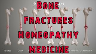 symphytum officinale homeopathic medicine in hindi  homeopathy for bone facture medicines [upl. by Yarg740]