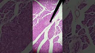 ¡Clave para identificar el PÁNCREAS ENDOCRINO en MICROSCOPIO histologíapancreas endocrino [upl. by Baryram]