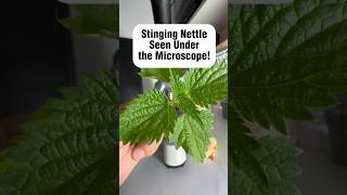 What Does Stinging Nettle Root Do For The Body [upl. by Airetnuhs]