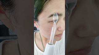 High frequency slaydarsonvalbeautyacnefacialbacktoschoolacnescarsskintreatmentacneremoval [upl. by Pepin]