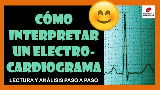 💓 CÓMO INTERPRETAR UN ELECTROCARDIOGRAMA 👉 Lectura y análisis paso a paso ☑️ [upl. by Clemence693]