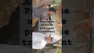 Short ytshort treatment of uterine prolapse [upl. by Anig]