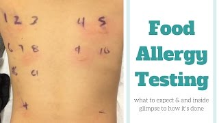 Food Allergy Testing [upl. by Leclair353]