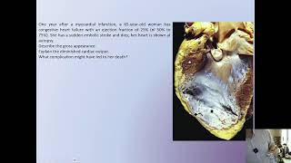 HEMODYNAMIC DISORDES CASES PART TWO  HARD DISEASES CASES PART 1 [upl. by Terrab980]