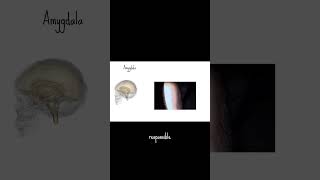 Brain beans amygdala brains [upl. by Aliuqet]