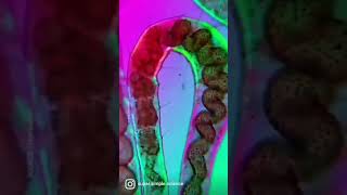 Worm displaying peristaltic movements I Peristalsis [upl. by Ekez]