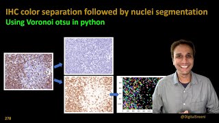 278  IHC color separation followed by nuclei segmentation using python [upl. by Dardani]