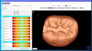 Demonstration of PrepScanner Technology Revolutionizing Dental Education and Assessment [upl. by Aurel]