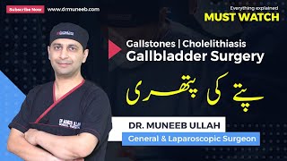 Gallstones  Cholelithiasis  Gallbladder Surgery  Everything explained MUST WATCH [upl. by Grath217]