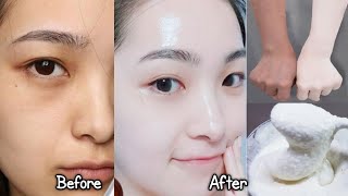 Japanese secret to whitening skin and get rid of pigmentation to get a fresh complexion [upl. by Trisa741]