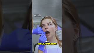 Troubleshooting Your Oral Health Solutions for Common Issues dental dentalhealth shortsvideo [upl. by Notlimah]