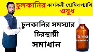 চুলকানির স্রষ্ঠ হোমিওপ্যাথি ওষুধ  Itching Homeopathy Medicines  Bangla [upl. by Pomfrey806]