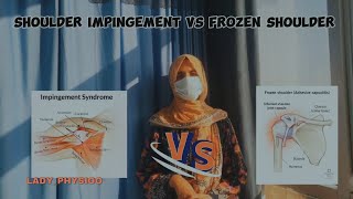 Frozen shoulder vs shoulder impingement Key differences causes symptoms and treatment [upl. by Ahsienek]