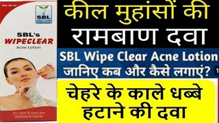 SBL WIPECLEAR ACNE DROPS  WIPECLEAR ACNE DROPS हिन्दी में पूरी जानकारी [upl. by Kostival372]