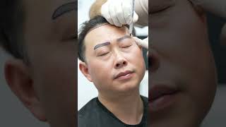 Hair and eyebrows transplant [upl. by Linus]