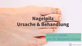 Nagelpilz Ursache amp Behandlung  Einfach erklärt mit Dr Durani Facharzt für Hautkrankheiten [upl. by Sibie636]