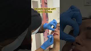 Non surgical nose tip lift music glutathione botox botulinumtoxin [upl. by Faucher]