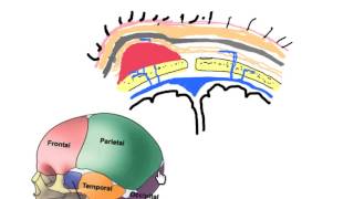 scalp hematomas in neonates [upl. by Ahtiekahs]