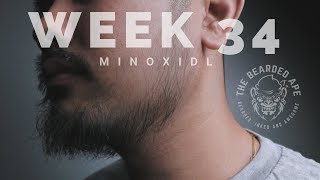 Minoxidil for Beard Growth WEEK 34 [upl. by Coralyn]