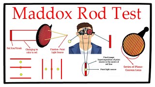 Maddox Rod Test A Complete Tutorial [upl. by Alodie]