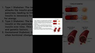 Responsible factors of diabetes and their solutions doctor medicine 2024 education diabetes [upl. by Ahsemot65]