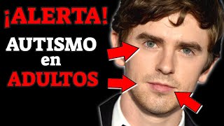 SINTOMAS de ALERTA de AUTISMO en ADULTOS que NO DEBES IGNORAR SINDROME DE ASPERGER [upl. by Elletnahs]