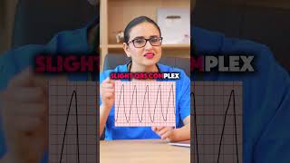 What Kind of ECG Is This Find Out What Your Heart’s Signals Meanshorts [upl. by Neryt]