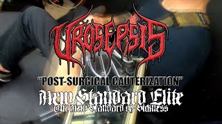 UROSEPSIS  quotPostSurgical Cauterizationquot Guitar Playthrough New Standard Elite  2022 [upl. by Allemac]