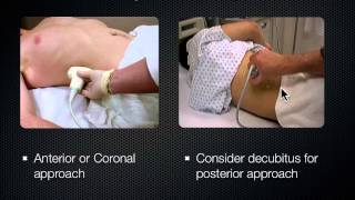 2 Kidney and Bladder Ultrasound [upl. by Ahsienet]